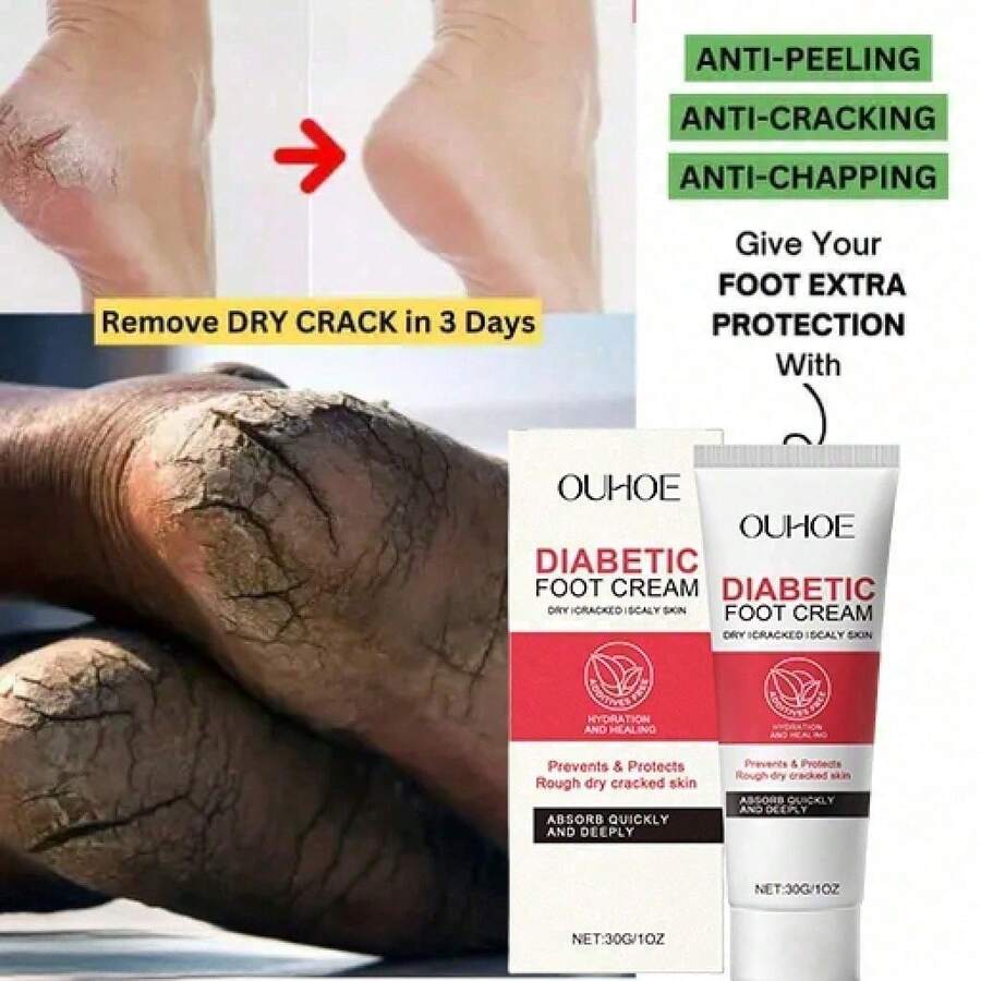 Foot Daily Nourishing Gentle Ingredients Moisturizing Hydrating Relieve Dryness Foot Care Foot - 1 - 查看 1