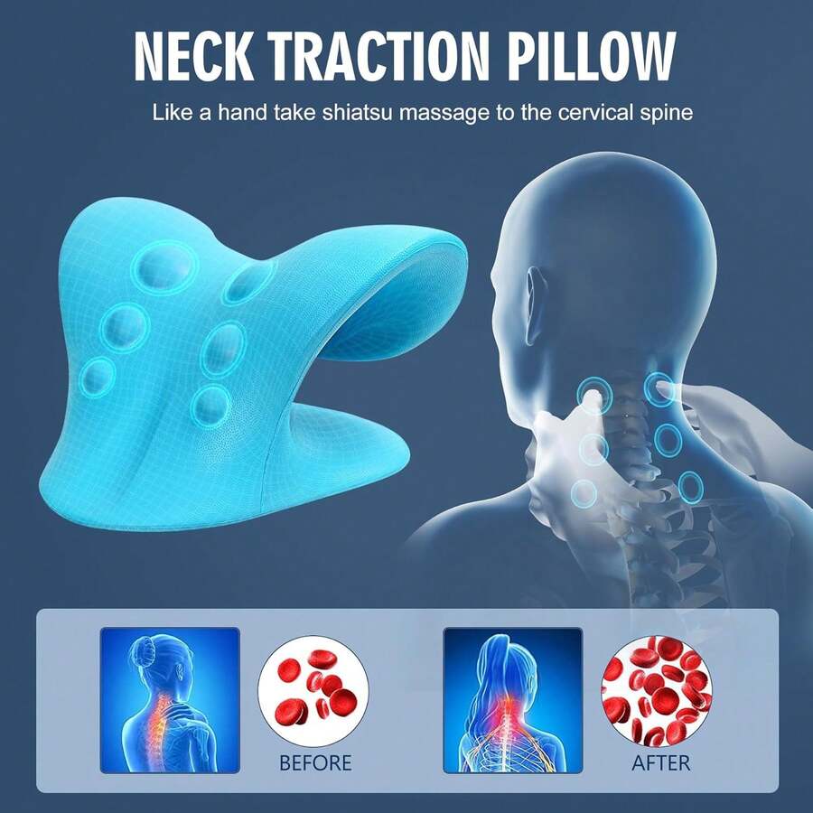Neck Stretcher For Pain Relief, Neck And Shoulder Relaxer Cervical Traction Device Pillow For Muscle Relax And TMJ Pain Relief - Blue - View 1