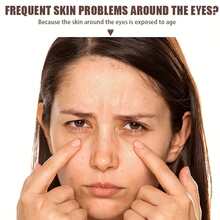 Xioimy 强效保湿紧致眼霜，蕴含玻尿酸、芦荟和维生素E，滋养提亮眼周肌肤，适合所有肤质。 - 數量 - 查看 7