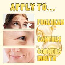 Xioimy 40片七字眼膜，高保湿，淡化黑眼圈，改善肤质，紧致眼周肌肤，提亮肤色，增强弹性，告别干燥暗沉，眼部护理，眼膜，眼贴 - 數量 - 查看 5