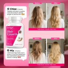 Aumenta el grosor y volumen del cabello, nutre el cuero cabelludo frágil y propenso a dañarse. Rico en diversas vitaminas, beneficioso para la salud del cabello, la piel y las uñas. Apto para hombres y mujeres (60 cápsulas). - 3 botellas - Ver 5