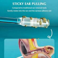 Sticky Ear Digger Ear Digging Tool Ear Wax Cleaning Special Not Hurt Ear Digging Spoon Ear Digging Cotton Swabs - 24pc - View 3