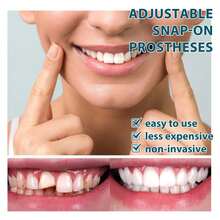 Adjustable Teeth Whitening Temporary Veneers Set, Removable Upper & Lower Jaw Fake Teeth Covers - Multicolor - View 5