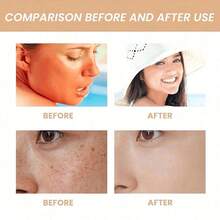 Daily Facial Sunscreen, Containing Broad-Spectrum Sunscreen, 40 Korean-Style Sunscreen Skincare Product, 50 Ml, 1.69 Oz - kem chống nắng - Xem 7