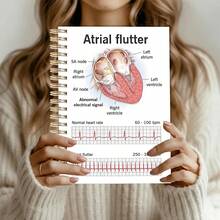 1PC 5.5x8.3" Heartbeat & ECG Spiral Notebook, Medical Nursing Journal For Doctors, Nurses & Medical Students, Smooth Writing Diary - A5 - View 2