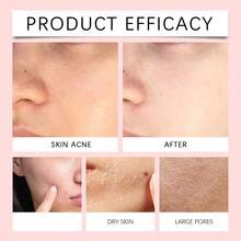 Viareline 114g Centella Facial Foam Cleanser - Deep Cleansing Pores Remove Dirt & Excess Grease Reduce Blackheads Improve Skin Texture Smoother Refreshing Oil Control Relieve Discomfort - Centella - 查看 9