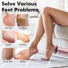 2-In-1 Electric Foot & Hand Care Tool, Electric Callus Remover & Foot File, 1200mAh - Rose Gold - View 6