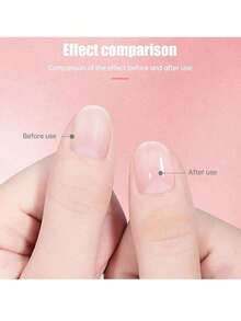 1/2Pcs Cosmetics Nail Growth Oil |   Nail Repair & Recovery Special |   Hand & Nail Care Oil |   Strengthens Nails & Boosts Growth |   Nourishes Cuticles & Prevents Hangnails |   Can Be Used With Nail Polish |   Nourishes Hand Skin Simultaneously ​ - 多色的 - 查看 9