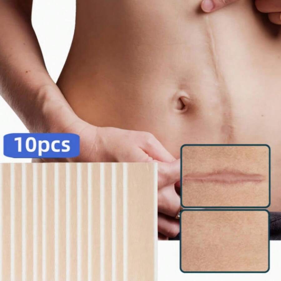 5 piezas de láminas de silicona para cicatrices, desvanecer y reparar cicatrices, estrías, cicatrices de cesárea - A - Ver 1
