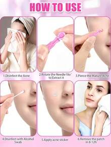 100 piezas de agujas estériles para el acné, herramientas desechables para eliminar puntos negros, efectivas para imperfecciones y puntos negros, adecuadas para todo tipo de piel, herramientas de limpieza facial para uso en salón y hogar - Multicolor - Ver 6