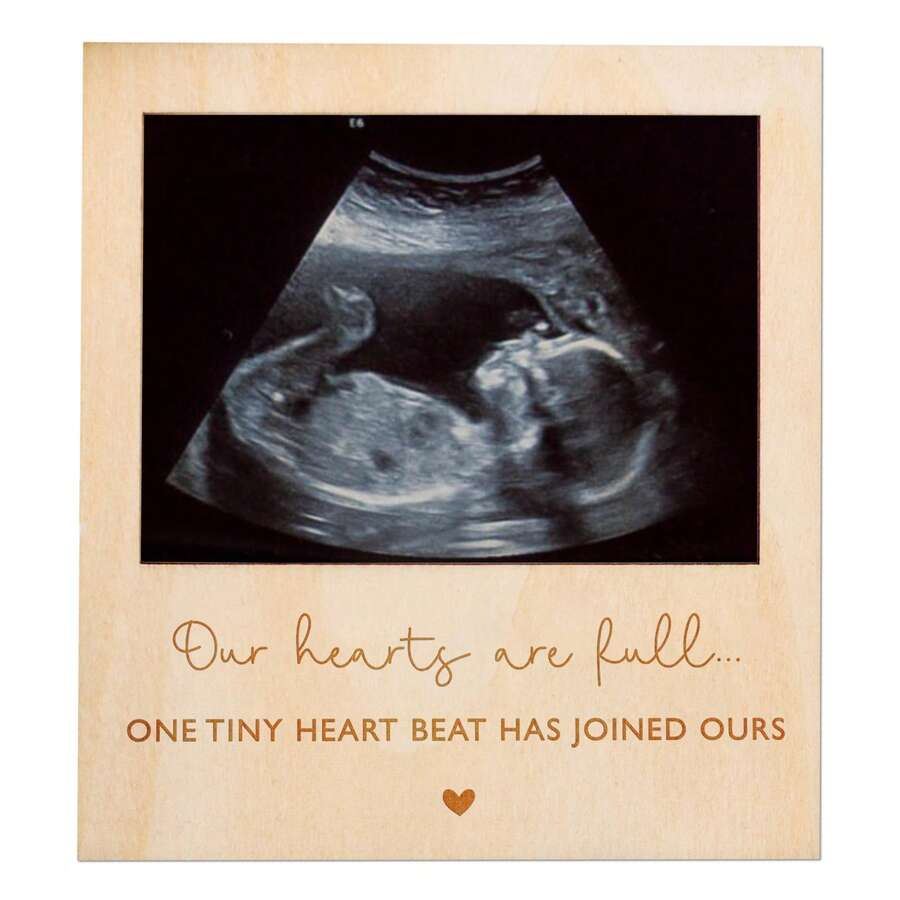 1个超声波照片相框，木质磁性孕期公告纪念品，适合性别揭晓派对装饰、婴儿派对礼物、给祖父母、丈夫、家人的惊喜、婴儿房墙面装饰、即将出生宝宝的公告板