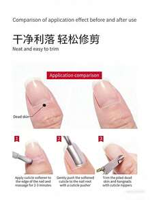 1 Set Stainless Steel Nail Clippers/Stainless Steel Silver Dual-Head Ingrown Toenail Lifter, For Removing Ingrown Nails & Nail Debris, Multi-Function Nail File, Professional Pedicure Tool, Foot Beauty File, Can Be Used To Clean Between Toes - One Size Fits All - View 6