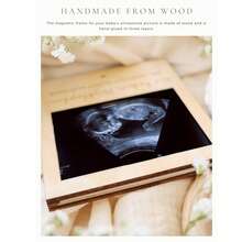 1个超声波照片相框，木质磁性孕期公告纪念品，适合性别揭晓派对装饰、婴儿派对礼物、给祖父母、丈夫、家人的惊喜、婴儿房墙面装饰、即将出生宝宝的公告板 - 彩色 - 查看 7