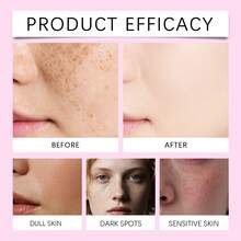 Hydrating Face Cream For Daily Skin Care, Soothing Moisturizer With Glycerin & Arbutin, Moisturizing Brightening Repair Cream Long-Lasting Hydrating Gentle Portable Design With Elastin Essence Skin Care, Suitable For Daily Use On Most Skin Types, Mother's Day Gifts, Father's Day Gifts, Skin Care Gifts - 肌膚保濕霜 - 查看 8