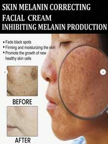 温和面霜，温和稳定肌肤状况，净化并改善肌肤质地。 - 1pc - 查看 3