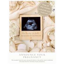 1个超声波照片相框，木质磁性孕期公告纪念品，适合性别揭晓派对装饰、婴儿派对礼物、给祖父母、丈夫、家人的惊喜、婴儿房墙面装饰、即将出生宝宝的公告板 - 彩色 - 查看 4