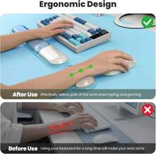 TECKNET Clear Gel Wrist Rest For Computer Keyboard, Ergonomic Gel Keyboard Wrist Rest Set For Typing Pain Relief, Comfortable Silicone Wrist Support Pad For Office/Computer/Laptop/Gaming, Blue - Màu A - Xem 3