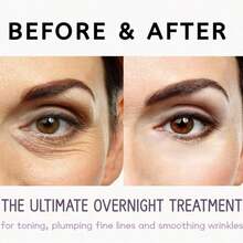 Eye Mask Patches, Tighten Eye Area Skin, Gentle & Non-Irritating, Relieve Eye Fatigue, Eye Mask Massage Gentle & Non-Irritating, Relieve Fatigue - Multicolor - View 5