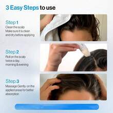 Be Bodywise Rosemary Hair Essence 25ml -3% Rosemary, 3% Ribose And 2% Anagain | Scalp Essence Can Promote Oxygen Flow, | No P-Hydroxybenzoate/Sulfate | Men And Women - 3% Hương thảo - Xem 5