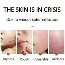 舒缓修护眼霜345，深层滋养，蕴含烟酰胺、积雪草、芙蓉花提取物和白藜芦醇，缓解眼部疲劳，提亮肤色，尤其适用于改善黑眼圈、眼袋和细纹，净重30克 - Nicotinamide - 查看 2