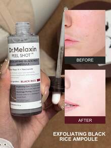 Dr.Melaxin 黑米去角质精华安瓶，亮肤、清洁毛孔、去除黑头，80毫升 - 黑米安瓶80ml - 查看 2