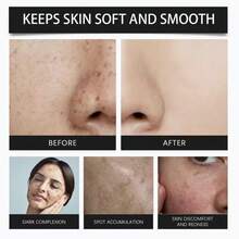 舒缓修护眼霜345，深层滋养，蕴含烟酰胺、积雪草、芙蓉花提取物和白藜芦醇，缓解眼部疲劳，提亮肤色，尤其适用于改善黑眼圈、眼袋和细纹，净重30克 - Nicotinamide - 查看 3