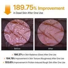 Exfoliating Turmeric Spray Body And Face Peel Spray Soothing Moisturizing Skin 200ml Exfoliating Kojic Acid Turmeric Spray - Hyaluronic Acid - 查看 8