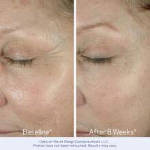 Obagi ELASTIDerm 眼霜 0.51盎司/15克 - All Skin Types - 查看 3