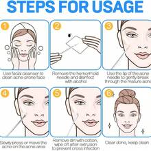 8 piezas Juego de herramientas para eliminar puntos negros, Juego de extractor de puntos negros, Juego de agujas para el acné (para tratamiento del acné), Tratamiento del acné (para imperfecciones de la piel facial) - Negro, Cuidado de la piel, Decoración de la habitación, Decoración del hogar, Decoración del dormitorio, Limpiador de puntos negros, Belleza, Productos de cuidado de la piel, Spa, Autocuidado, Herramientas para el cuidado facial, Cuidado facial, Suministros de belleza, Piel, Limpieza, Rostro - Negro - Ver 10