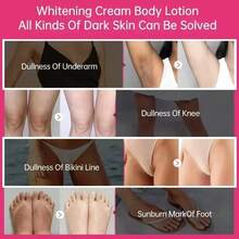 100g,Body Whitening And Firming Cream, Deeply Moisturizing And Whitening Underarm Joints And Inner Thigh Skin, Light And Moisturizing Skin Care Cream - Làm trắng - Xem 2