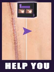 Skin Tool Everyday Use Effortless  All Groups Of People Can Use It - 1 - View 1