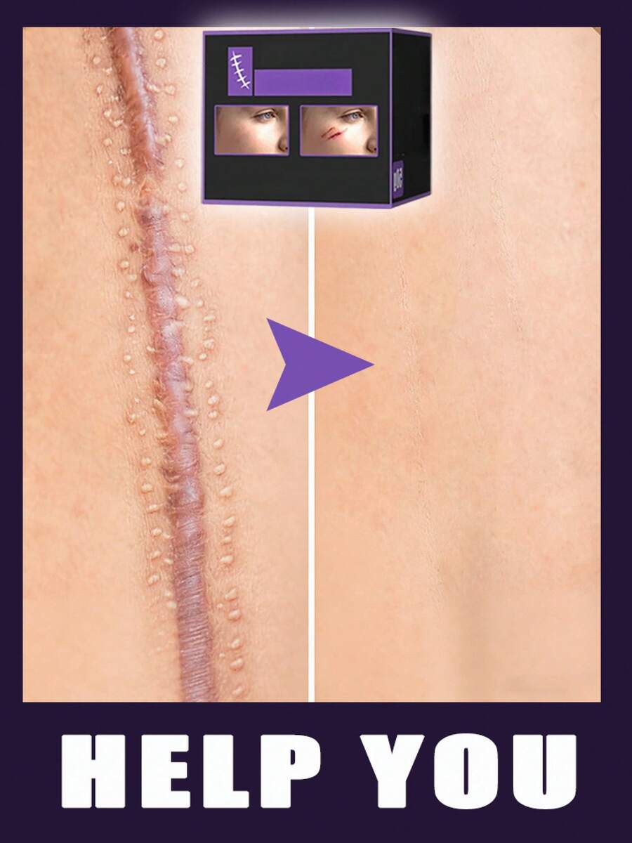 Skin Tool Everyday Use Effortless  All Groups Of People Can Use It - 1 - View 1