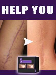 Skin Tool Everyday Use Effortless  All Groups Of People Can Use It - 1 - View 2