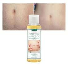 100毫升肌肤屏障修复油，淡化妊娠纹，深层滋养，保湿，改善暗沉和干燥 - 妊娠油 - 查看 6