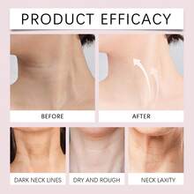 Hoygi Neck & Face Night Cream - Deep Nourishment, Lock Moisture And Improve Dryness, Fade Neck Lines And Facial Wrinkles, Enhance Skin Luster And Elasticity, Smooth Texture, Easy To Spread, Moisturizing Repair Anti-Aging Essence Skin Care - Cream - View 10