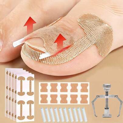 17pcs/Set Ingrown Toenail Correction Pads, Nail Correction Stickers, Painless Ingrown Nail Improvement Tools, Suitable For Various Foot Care
