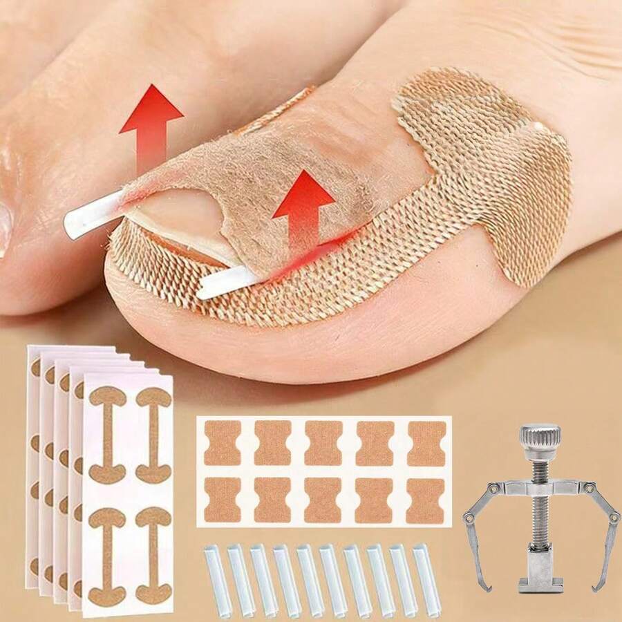 1/10/17pcs/Set Ingrown Toenail Correction Pads Nail Correction Stickers Ingrown Toenail Tools Suitable For All Types Of Foot Care - Multicolor - View 1