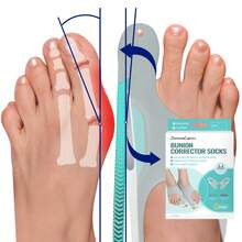 Tech Love 1 Pair Corrector Bunion  Toe Separator For Women Men, Toe Separator In Shoes With Gel Cushion Pads For Big Toe, Adjustable Toe Separator Sleeves With 4 PCS Fixing Plates Day Night(Medium) - Light Grey - View 2