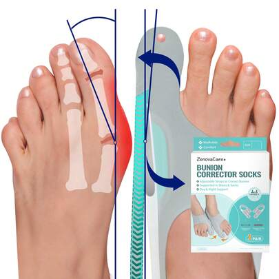 Tech Love 1 Pair Corrector Bunion  Toe Separator For Women Men, Toe Separator In Shoes With Gel Cushion Pads For Big Toe, Adjustable Toe Separator Sleeves With 4 PCS Fixing Plates Day Night(Medium)