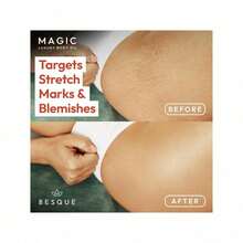 Besque Magic Body Oil, 3.38 FL OZ, After Shower Body Oil For Women, Hydrating Skin Care For Full Body That Plumps, Tightens, And Firms Skin With Natural Ingredients, Luxury Spa Gifts - Pack Of 1 - 1 - 查看 4