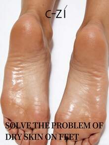C-ZI 40% 尿素乳霜 + 2% 水杨酸，保湿滋润，滋养干燥、粗糙和皲裂肌肤，100克/3.52盎司 - 100g - 查看 8