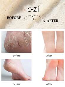 CI-ZI Exfoliante de pies de cúrcuma, elimina suavemente los callos, nutre profundamente, hidrata, deja la piel suave y radiante - Honey - Ver 5