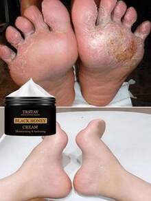 Moisturizing Whitening Foot Cream Fragrance Free Formula Deeply Hydrates Removes Calluses Exfoliates Dead Skin Prevents Dryness Cracking For Ultra Soft Smooth Feet All Day Long - 多色的 - 查看 4