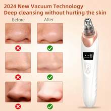 Blackhead Pore Removal Vacuum, Facial Pore Cleanser - 5 Suctions, 5 Probes, USB Rechargeable Blackhead Vacuum Kit, Acne Removal Tool For Adults. Suitable For Bathrooms. Bedchamber. Holiday Gifts For Female Friends And Female Classmates In Places Such As Travel,Back To School - Thiết bị làm sạch da - Xem 6