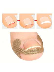 4/20/40/80pcs Painless Ingrown Toenail Correction Patches, Easy-To-Use Home Pull-Up Toe Nail Relief Tool, Soft Natural Shaping Foot Care For Men And Women, Portable Daily Essential For All Seasons, Slouchy-Friendly Pedicure Accessory - Multicolor - View 3