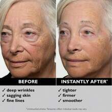 Tightening Eye Cream Can Fade Fine Lines, Dark Eye Bags, And Dark Circles, Tighten The Skin Around The Eyes, Moisturize The Eye Cream, Instant FIRMx Temporary Eye Tightening Double Set | Tightening And Smooth Fine Line Effect Immediately Reduces Eye Bags, Dark Circles, And Swelling, Anti-Aging Fine Lines, And Tightens Your Delicate Skin Under The Eyes - kem dưỡng mắt tối màu - Xem 6