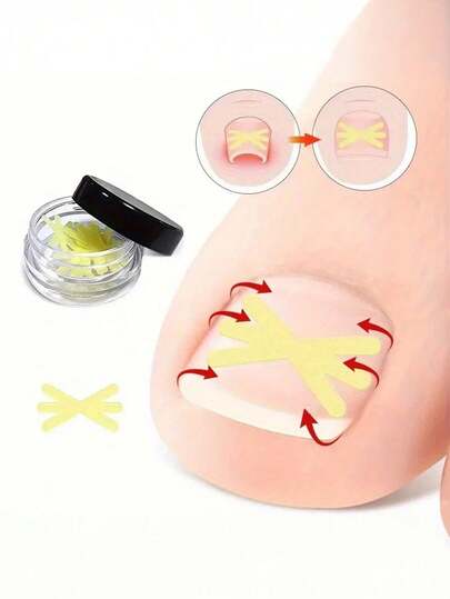 10pcs Toe Separator Nail Correction Stickers, Physical Stretching Patch, Discreet & Compact