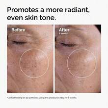 Glycolic Acid Toner, Removes Skin Imperfections, Keeps The Skin Hydrated And Clear, Provides Continuous Moisturizing And Replenishment. Lightweight Texture, Easy To Absorb, Provides Deep Hydration, Nourishment, Brightening, And Facial Smoothing Effects. - Aloe Vera - 查看 7