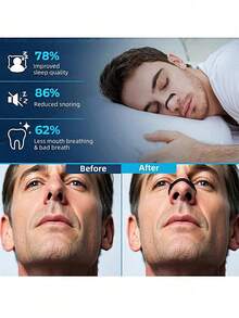 60 Count Magnetic Nose Strip – Nose Magnet For Breathing, Magnetic Strips For Men And Women, Breathe Smoothly With Nose Magnets, Reduce Snoring, Improve Sleep Quality - 多色的 - 查看 3