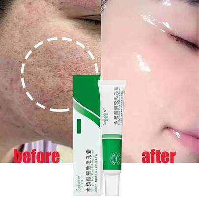 20 ml Crème visage à l'acide salicylique, rétrécit les pores, rajeunit, hydrate, nourrit, élimine les points noirs. Sérum anti-âge et contrôle de l'huile